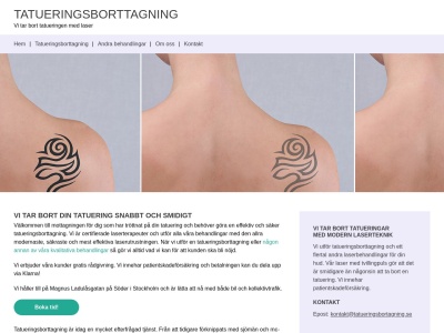 tatueringsbortagning.se
